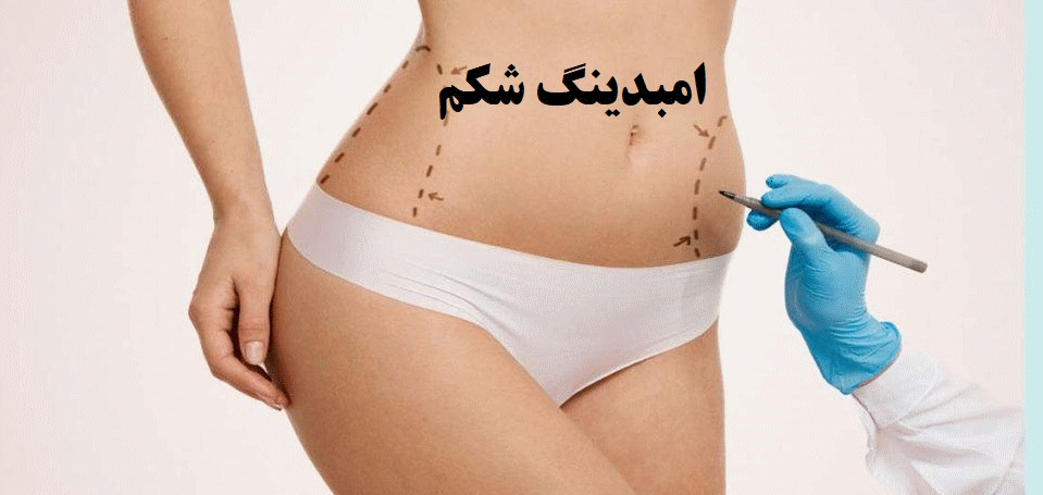 امبدینگ شکم