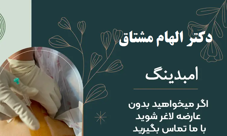 امبدینگ شکم