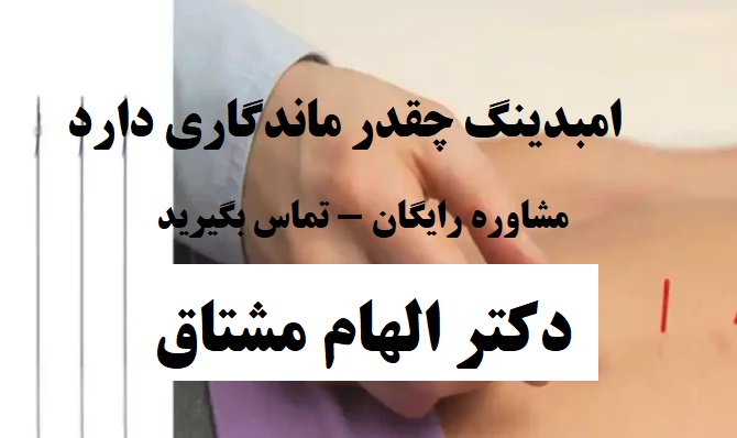 امبدینگ چقدر ماندگاری دارد
