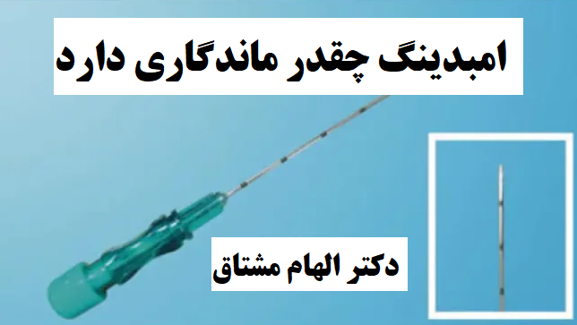 امبدینگ چقدر ماندگاری دارد