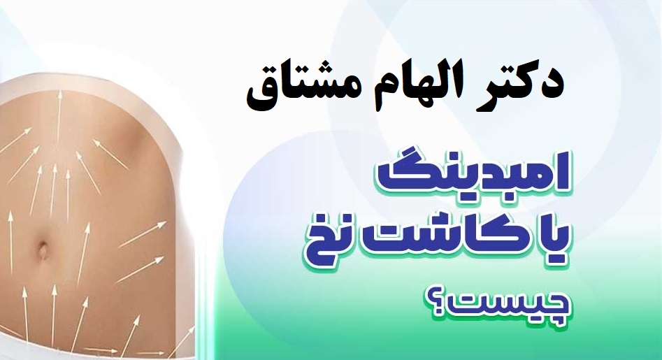 امبدینگ چه روشی است