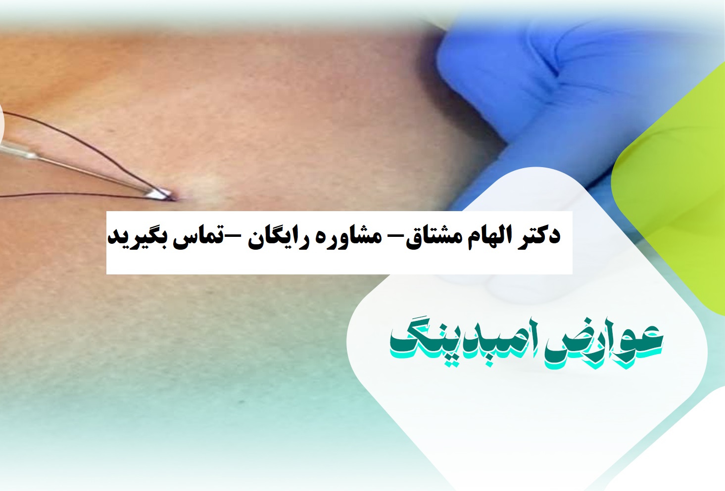 عوارض امبدینگ