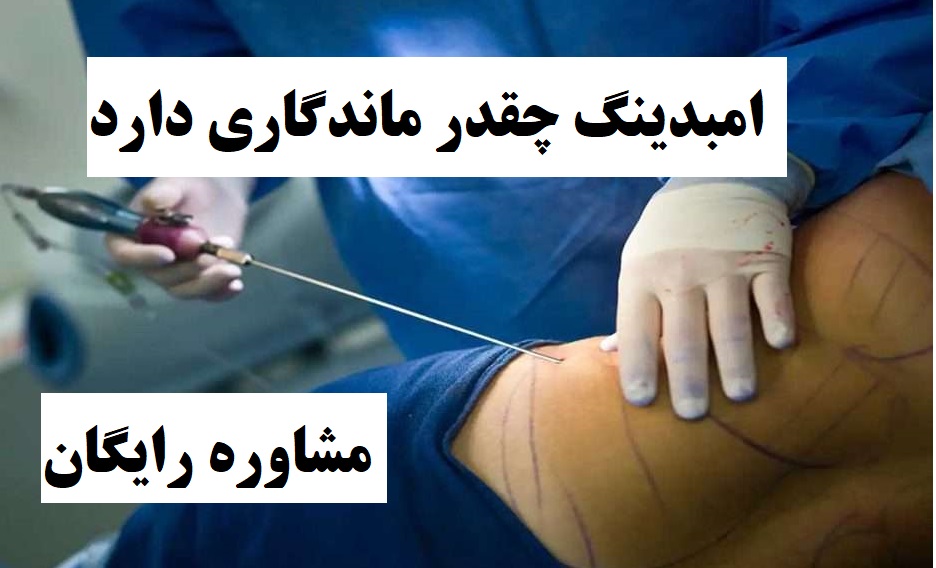 ماندگاری امبدینگ