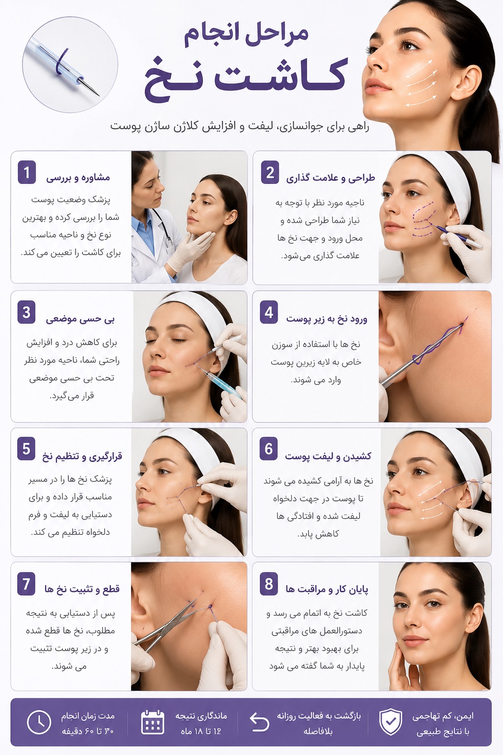 اینفوگرافی مراحل انجام کاشت نخ لاغری