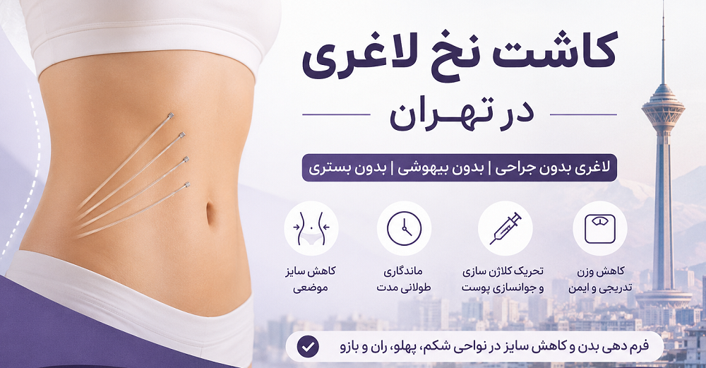کاشت نخ لاغری در تهران